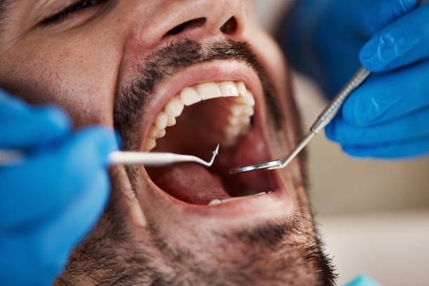 Best Pediatric Emergency Dentist in New Baltimore, OH